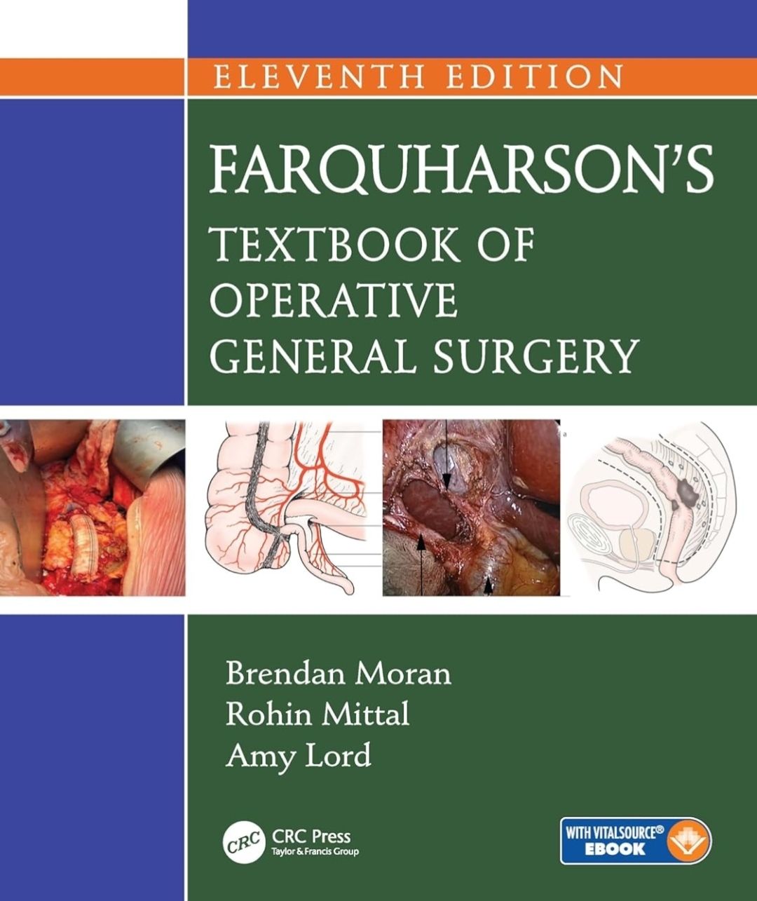 Farquharson&#39;s Textbook of Operative General Surgery 11th Edition 2025