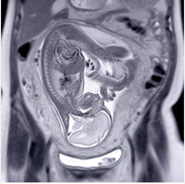 Pediatric Body MRI 2015 (Videos)