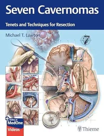 Seven Cavernomas: Tenets and Techniques for Resection