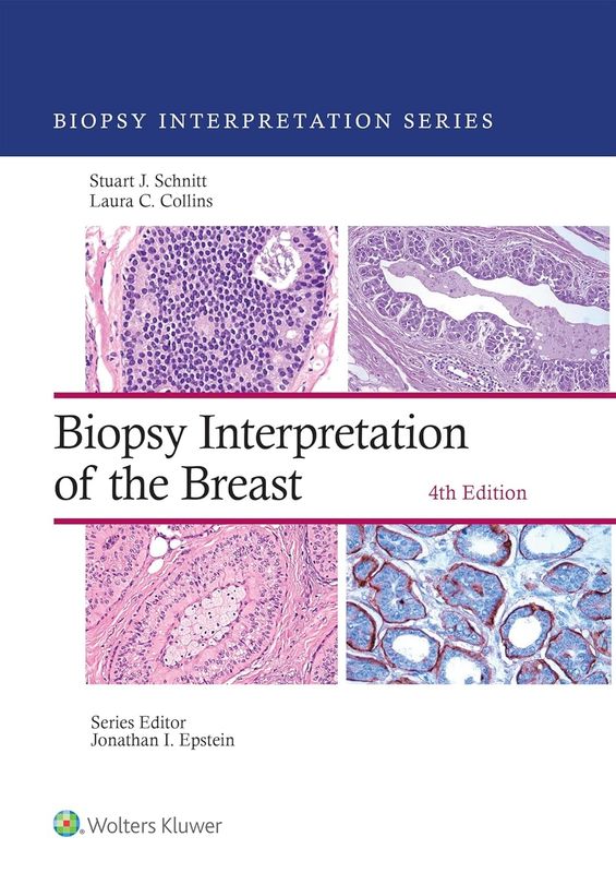 Biopsy Interpretation of the breast 4th Edition 2025 (Biopsy Interpretation Series)