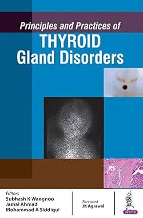 Principles and Practices of Thyroid Gland Disorders (Original PDF from Publisher)