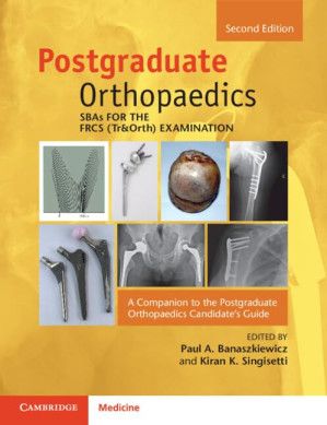 SBAs for the FRCS (Tr&amp;Orth) Examination - A Companion to the Postgraduate Orthopaedics Candidate&#39;s Guide, 2e