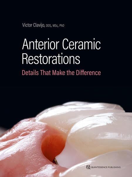 Anterior Ceramic Restorations: Details That Make the Difference