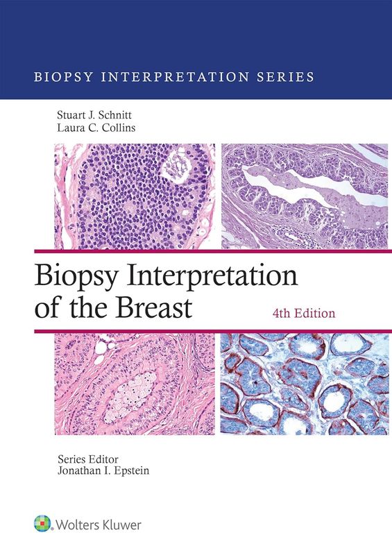 Biopsy Interpretation of the Breast (Biopsy Interpretation Series), 4th Edition