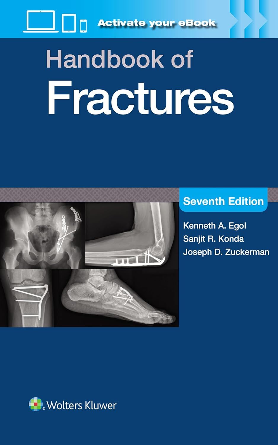 Handbook of Fractures, 7th Edition