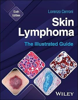 Skin Lymphoma: The Illustrated Guide, 6th edition (Original PDF from Publisher)