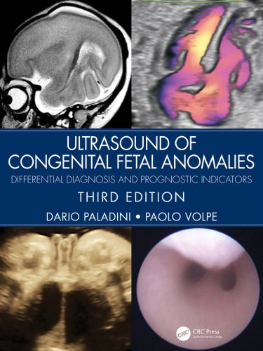 ULTRASOUND OF CONGENITAL FETAL ANOMALIES