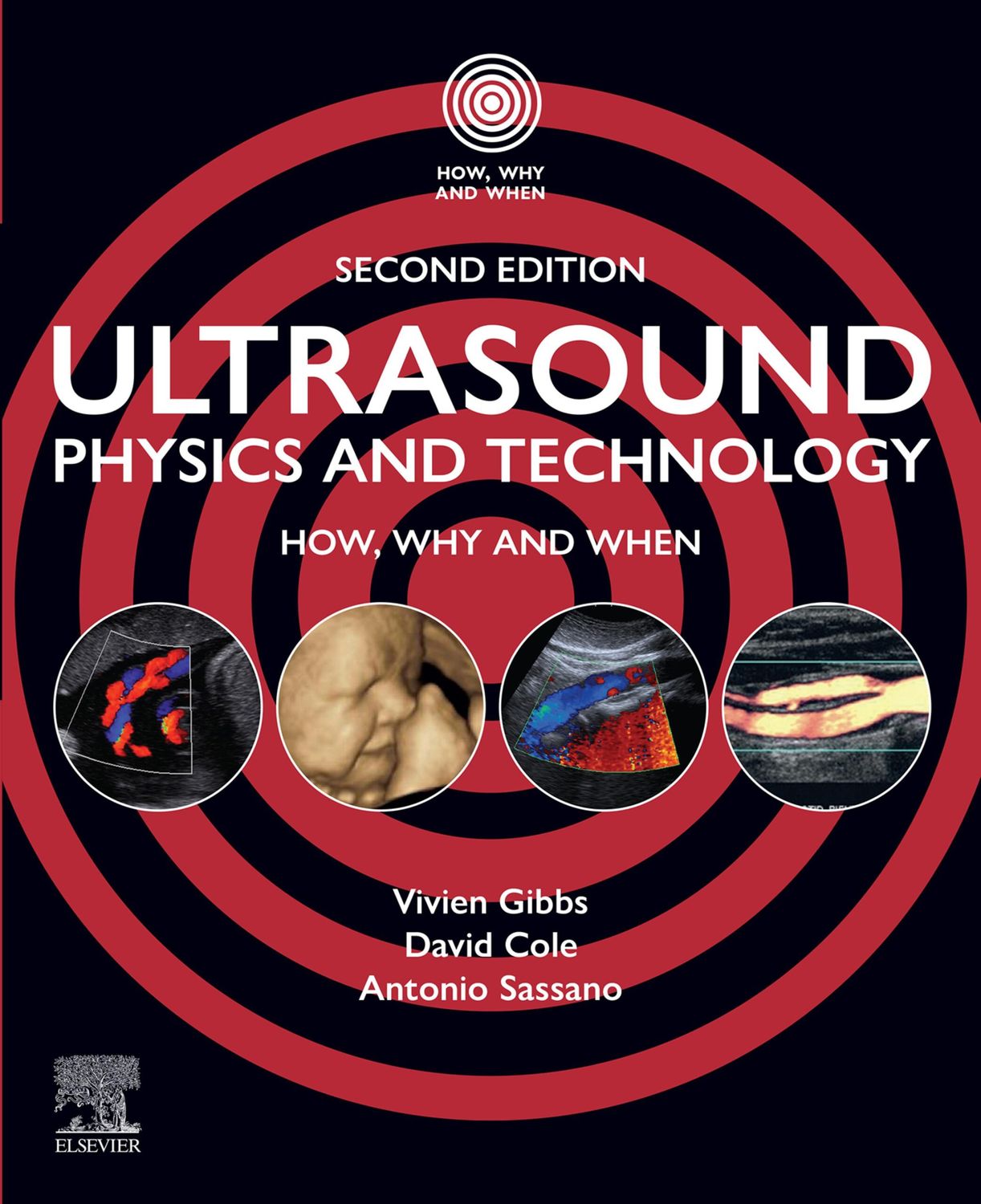 Ultrasound Physics and Technology, 2nd Edition