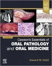 Cawson’s Essentials Of Oral Pathology And Oral Medicine, 10th Edition