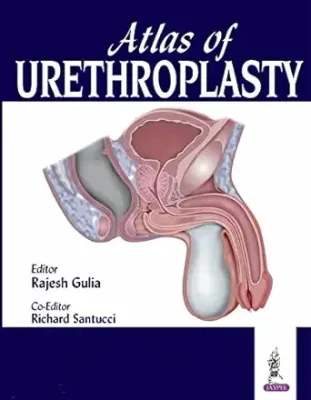 Atlas of Urethroplasty