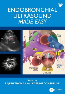 Endobronchial Ultrasound Made Easy