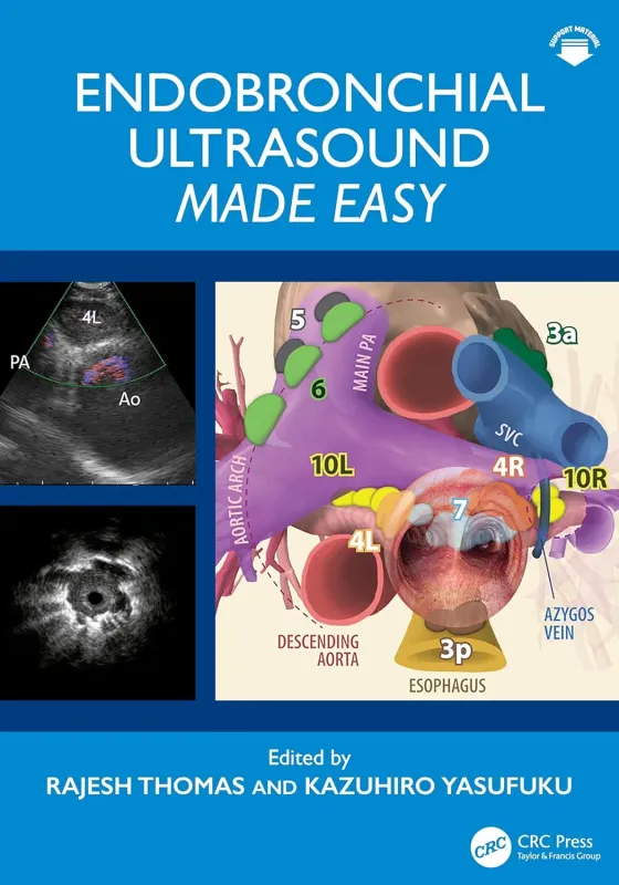 Endobronchial Ultrasound Made Easy