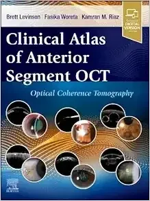 Clinical Atlas Of Anterior Segment OCT: Optical Coherence Tomography