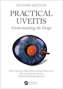 Practical Uveitis, 2nd edition (Original PDF from Publisher)