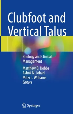 Clubfoot and Vertical Talus: Etiology and Clinical Management
1st ed. 2023 Edition