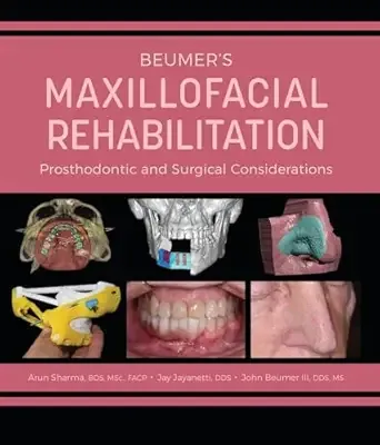 Beumer’s Maxillofacial Rehabilitation: Prosthodontics and Surgical Considerations
