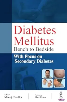 Secondary Diabetes: Understanding Causes and Management