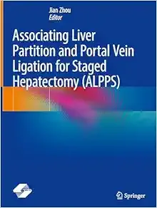 Associating Liver Partition and Portal Vein Ligation for Staged Hepatectomy (ALPPS) (Original PDF from Publisher)
