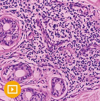 Dermatopathology Videos Course / Lectures 2023