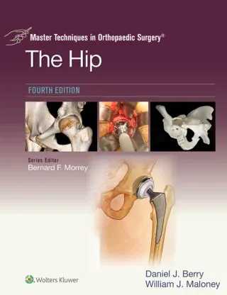 Master Techniques in Orthopaedic Surgery: The Hip, 4th Edition