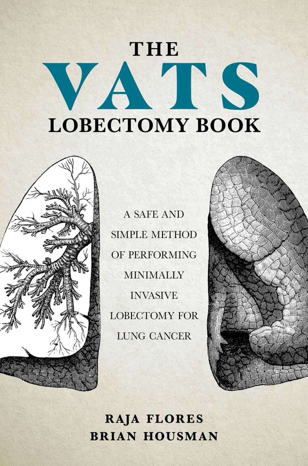 The VATS Lobectomy Book (Original PDF from Publisher)