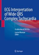 ECG Interpretation of Wide QRS Complex Tachycardia - A collection of 50 ECGs