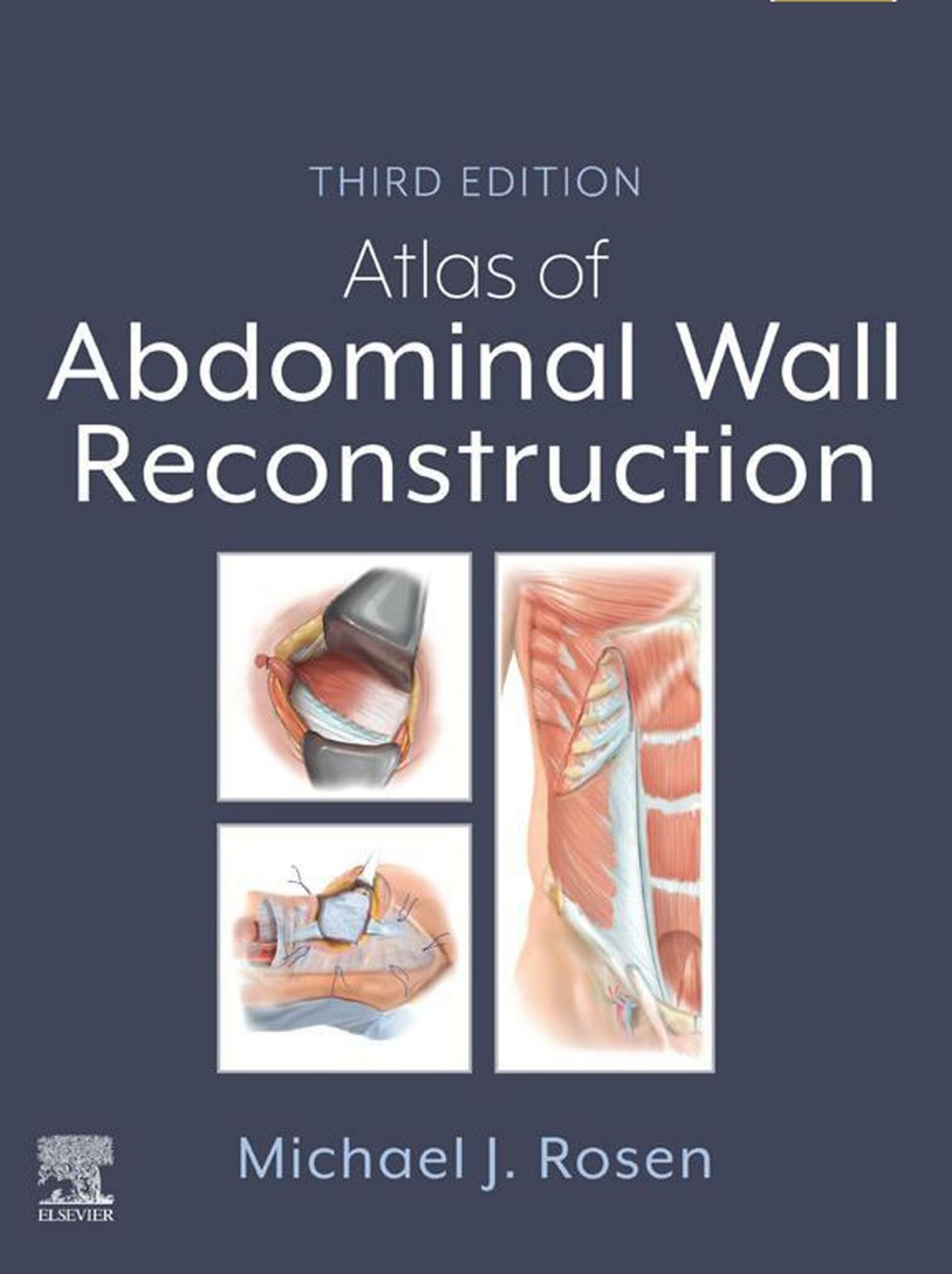 Atlas of abdominal wall reconstruction 3rd edition 