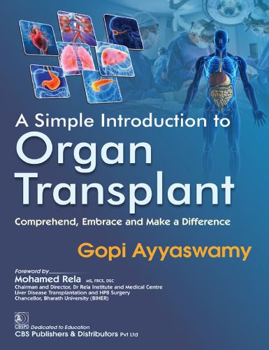A Simple Introduction to Organ Transplant