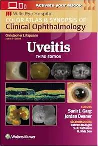 Uveitis: Color Atlas and Synopsis of Clinical Ophthalmology