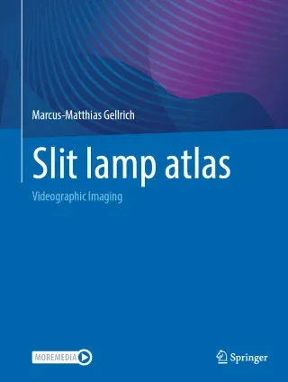Slit lamp atlas, 2025th Edition (Original PDF from Publisher)