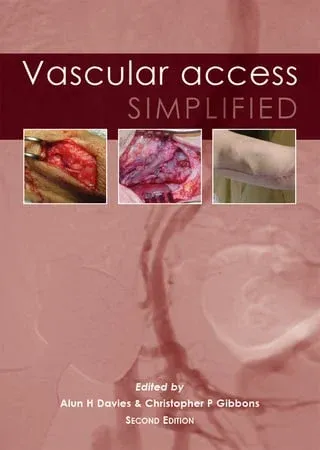 Vascular Access Simplified, 2nd Edition