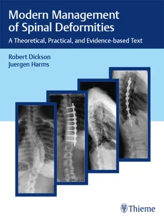Modern Management of Spinal Deformities