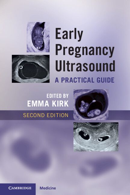 Early Pregnancy Ultrasound: A Practical Guide, 2nd edition