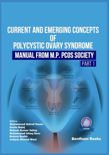 management of Polycystic Ovary Syndrome
