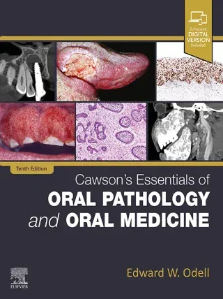 Essentials of Oral Pathology and Oral Medicine, 10th EditionBy