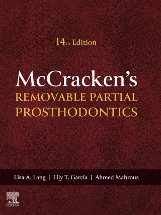 Removable Partial Prosthodontics, 14th Edition