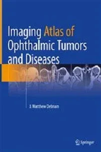 Imaging Atlas of Ophthalmic Tumors and Diseases