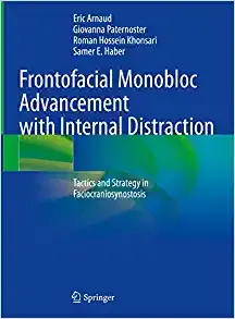 Frontofacial Monobloc Advancement with Internal Distraction: Tactics and Strategy in Faciocraniosynostosis (Original PDF from Publisher)