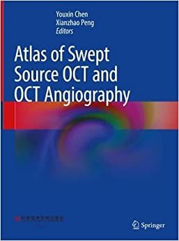 Atlas of Swept Source OCT and OCT Angiography