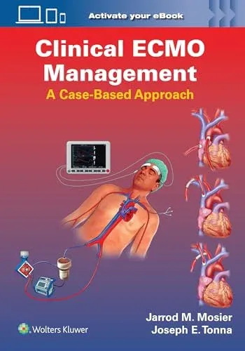 Clinical ECMO Management: A Case-Based Approach