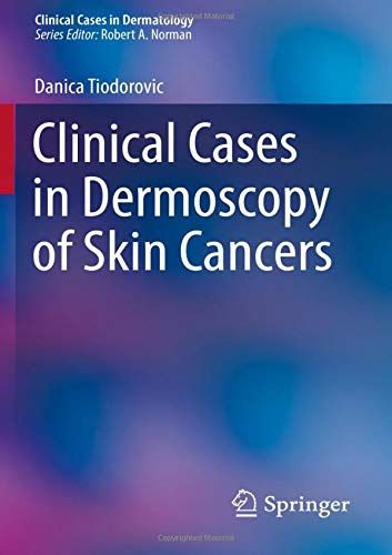 Clinical Cases in Dermoscopy of Skin Cancers (Clinical Cases in Dermatology) (