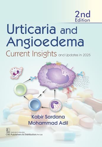 Urticaria and Angioedema Current Insights and Updates in 2025, 2nd edition