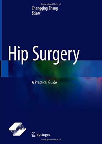 Hip Surgery: A Practical Guide
