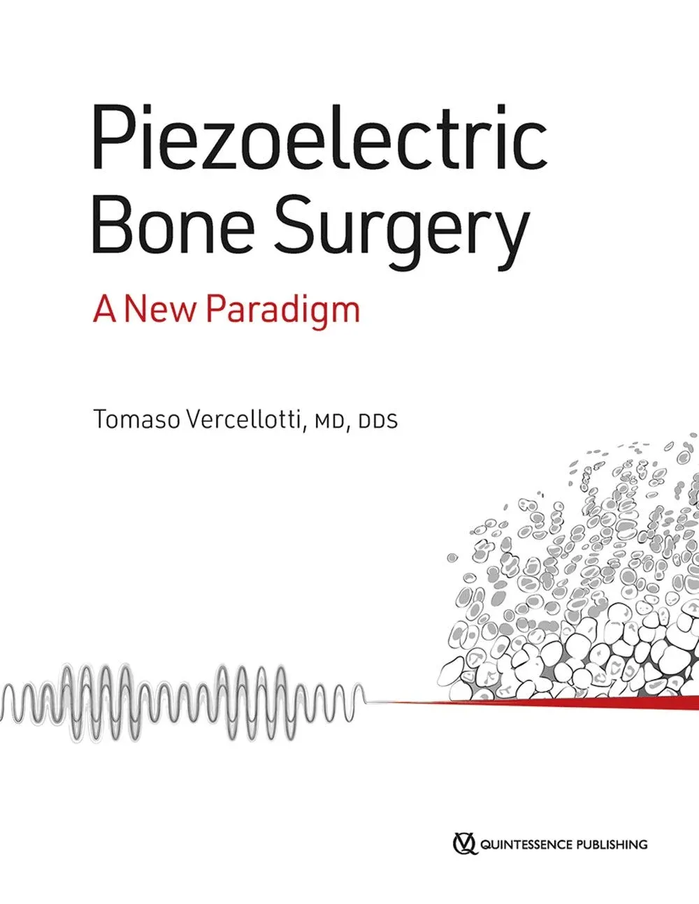 Piezoelectric Bone Surgery: A New Paradigm (Original PDF from Publisher)
