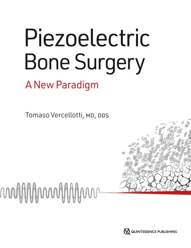 Piezoelectric Bone Surgery: A New Paradigm (Original PDF from Publisher)