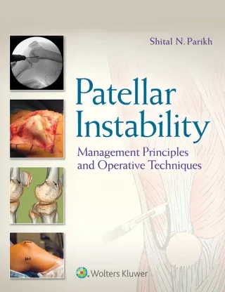 Patellar Instability and Dislocation: Classification and Operative Techniques