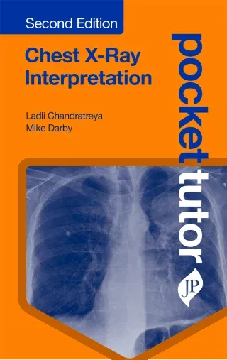 Pocket Tutor: Chest X-Ray Interpretation, 2nd Edition