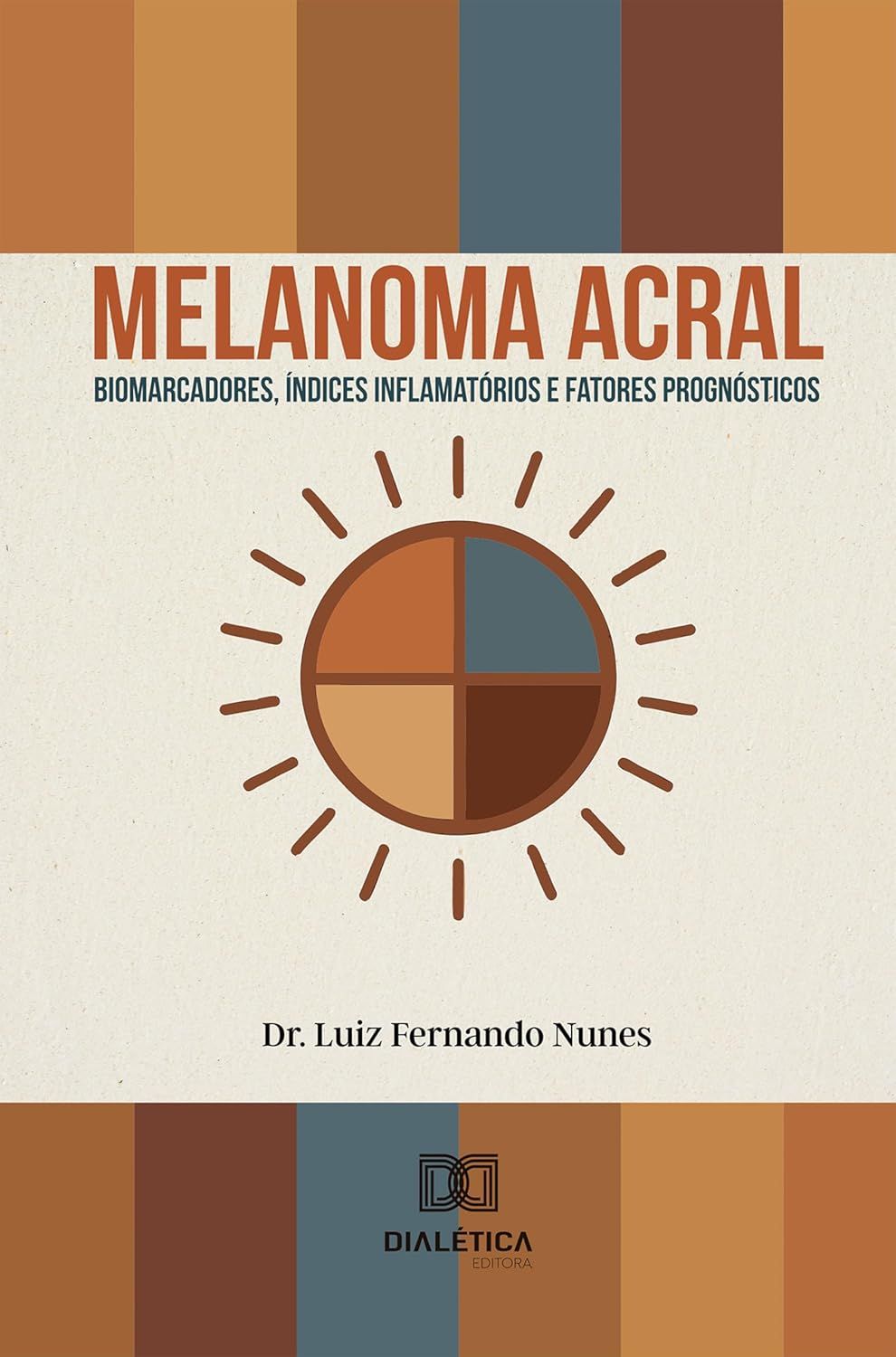 Melanoma acral: Biomarcadores, índices inflamatórios e fatores prognósticos (Portuguese Edition)