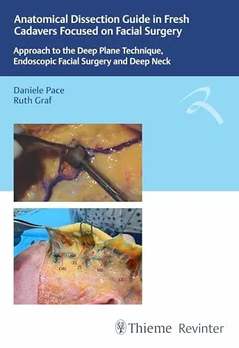 Anatomical Dissection Guide in Fresh Cadavers Focused on Facial Surgery: Approach to the Deep Plane Technique, Endoscopic Facial Surgery and Deep Neck