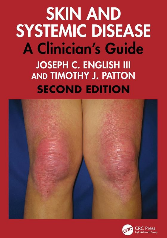 Skin and Systemic Disease: A Clinician's Guide, Second Edition
